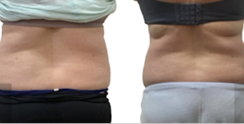 180 BODY SCULPTING Updated September 2024 10 Photos Aliso Viejo