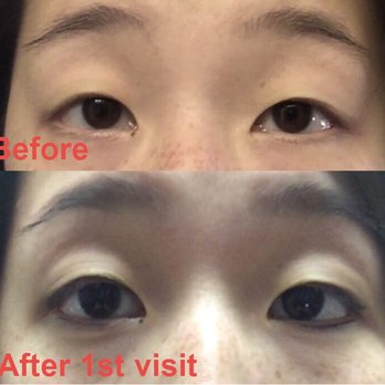 So Natural Permanent Cosmetics - Upper and lower eyeliner. First appointment. I hope to post a follow up pic after my follow up appointment - Skin Care Near Me - Des Peres, Missouri So Natural Permanent Cosmetics - Upper and lower eyeliner. First appointment. I hope to post a follow up pic after my follow up appointment - Skin Care Near Me - Des Peres, Missouri