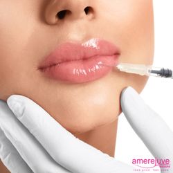 Amerejuve - Lip Fillers