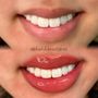 Photo of Blushd Beauty Bar