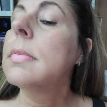 Dr Landa Med Spa - Medical Spas Near Me - Oakland Park, Florida Dr Landa Med Spa - Medical Spas Near Me - Oakland Park, Florida