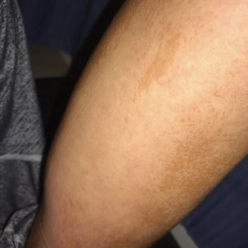 Palm Beach Tan - Spray tan disasters - Skin Care Near Me - Amelia, Ohio Palm Beach Tan - Spray tan disasters - Skin Care Near Me - Amelia, Ohio