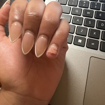 N Nails & Spa Lounge - Second broken nail that is beyond repair. - Nail Salons Near Me - Baltimore, Maryland