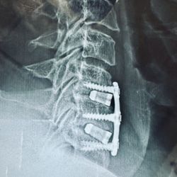 Alpesh A Patel, MD