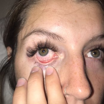 FlirtyLash spa & Supplies - Eye burn - Skin Care Near Me - Reno, Nevada