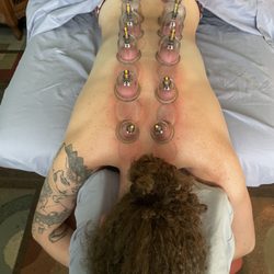 Massage By Jessie - Cupping therapy