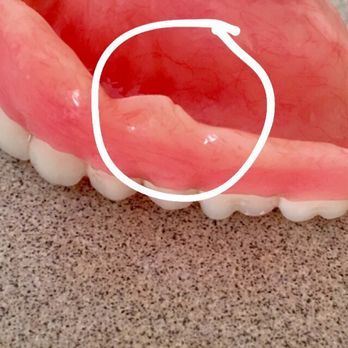 iSmile at The Avenues - Cosmetic Dentists Near Me - Salt Lake City, Utah iSmile at The Avenues - Cosmetic Dentists Near Me - Salt Lake City, Utah