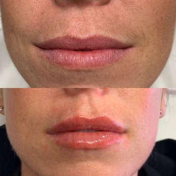 Beauty Babe Club - Permanent Makeup Near Me - La Jolla, California Beauty Babe Club - Permanent Makeup Near Me - La Jolla, California