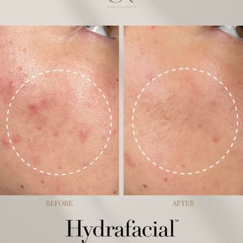 Skin Restored - Medical Spas Near Me - Fresno, California Skin Restored - Medical Spas Near Me - Fresno, California