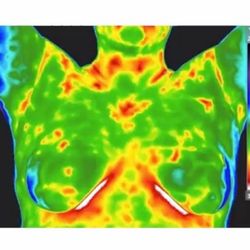 Safe Body Imaging - Safe Breast Thermal Imaging