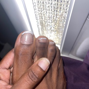 Bellagio Nails Bar - FRENCH TIP IS NOT EVEN COVERING MY WHOLE TOENAIL!TERRIBLE JOB!! - Nail Salons Near Me - Plano, Texas Bellagio Nails Bar - FRENCH TIP IS NOT EVEN COVERING MY WHOLE TOENAIL!TERRIBLE JOB!! - Nail Salons Near Me - Plano, Texas