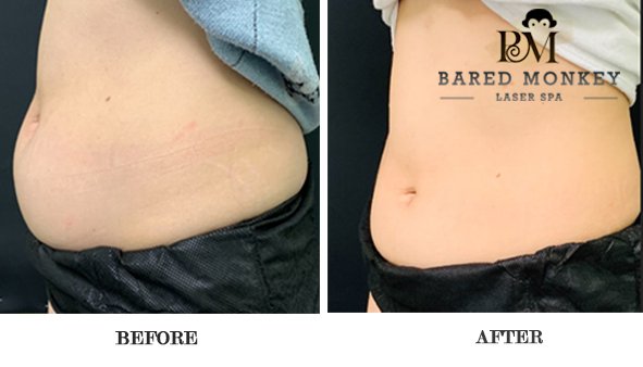 Bared Monkey Laser Spa by null