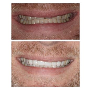 Prestige Dentistry - Trinity - General Dentistry Near Me - Trinity, Florida Prestige Dentistry - Trinity - General Dentistry Near Me - Trinity, Florida