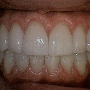 Adriana Barrera, DDS - Barrera Advanced Dentistry - Cosmetic Dentists Near Me - Torrance, California Adriana Barrera, DDS - Barrera Advanced Dentistry - Cosmetic Dentists Near Me - Torrance, California