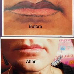 All About Faces - Lip permanent makeup before and after