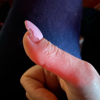 Marcel's Nail& Salon - Blistered/peeling shellac after 24 hours - Nail Salons Near Me - Deer Park, Texas Marcel's Nail& Salon - Blistered/peeling shellac after 24 hours - Nail Salons Near Me - Deer Park, Texas