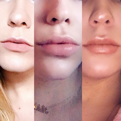 Skin Deep Med Spa 33 Photos 63 Reviews Medical Spas 231 Newbury St Boston Ma United States Phone Number Yelp