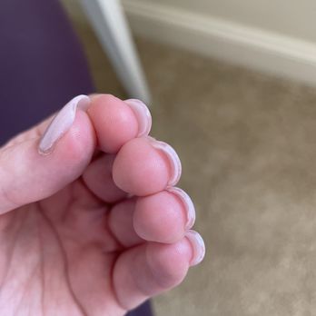 Party Nails And Spa - So thick and splotchy, and there's acrylic under my nails. - Nail Salons Near Me - Monroe, North Carolina Party Nails And Spa - So thick and splotchy, and there's acrylic under my nails. - Nail Salons Near Me - Monroe, North Carolina