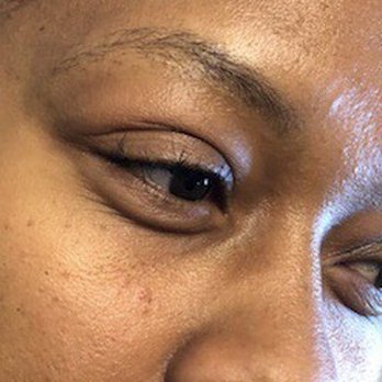 MV Vital Permanent Makeup - Before - Permanent Makeup Near Me - Montclair, California