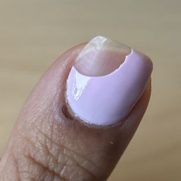 Chipped nail & my healing cut