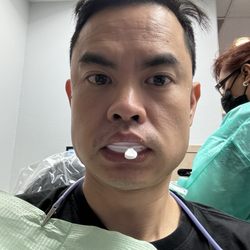 Irvine Smiles Dental - Impressions
