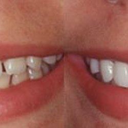 Downtown Dental