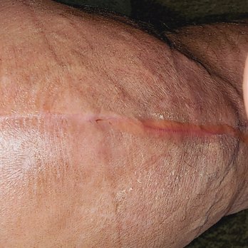 John Thompson, DO - Joint Implant Surgeons - Orthopedists Near Me - Cape Coral, Florida John Thompson, DO - Joint Implant Surgeons - Orthopedists Near Me - Cape Coral, Florida