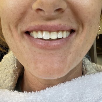 Restore Dental Studio - Cosmetic Dentists Near Me - Agoura Hills, California Restore Dental Studio - Cosmetic Dentists Near Me - Agoura Hills, California