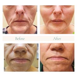 Sienna Skin Care - Dr. Cadoux Before and After