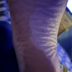 Sun Tan City - Welp.