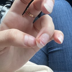 Ck Nails & Spa - How damaged my nail is now