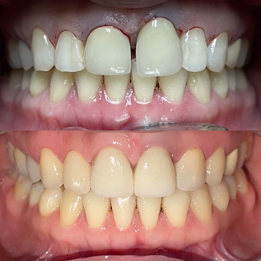 AUSTIN DENTAL CARE Updated September 2024 3745 89th St, Jackson