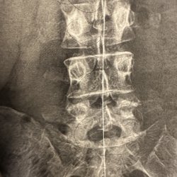 X-ray example