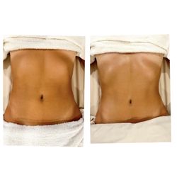 Lymphatic Drainage, decreased bloating, improved digestion, immune boosting, skin tightening, added aesthetic bonus.