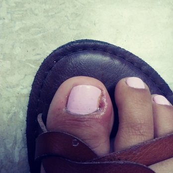 Allure Nails and Spa - Horrible! I will never come here again!both toes infected - Nail Salons Near Me - Rialto, California