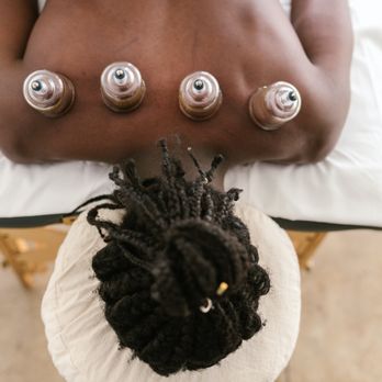 BT Wellness - Cupping is like massage but instead of using positive pressure (pushing in), it uses negative pressure (pulling up). - Acupuncture Near Me - Los Alamitos, California BT Wellness - Cupping is like massage but instead of using positive pressure (pushing in), it uses negative pressure (pulling up). - Acupuncture Near Me - Los Alamitos, California