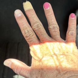 Cut down nails post peeling and ripping. Cut down nails post peeling and ripping.
