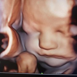 Blooming Bellies Boutique - HD image of a 3rd trimester baby
