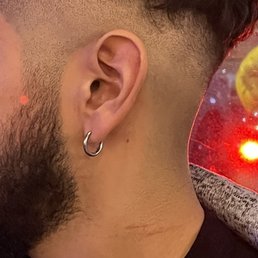 Deep cuts on neck Deep cuts on neck