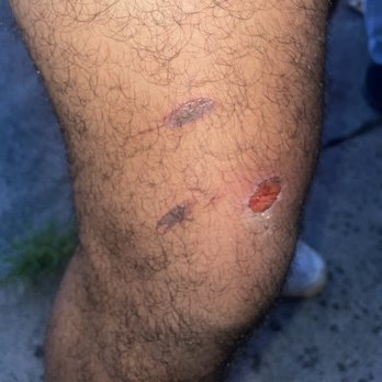 Sikdorak III - Burns from an employee changing out the grill carelessly. - Korean Near Me - Aiea, Hawaii Sikdorak III - Burns from an employee changing out the grill carelessly. - Korean Near Me - Aiea, Hawaii