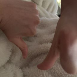 two hands doing thumbs down