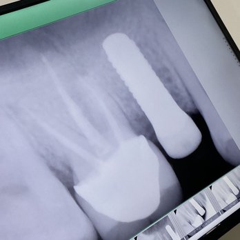 BioDental Care - General Dentistry Near Me - Tijuana, BCN