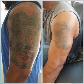 West Hudson Tattoo - Before and after - Tattoo Near Me - Harrison, New Jersey
