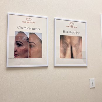 The Med Spa - Laser Hair Removal Near Me - Las Vegas, Nevada The Med Spa - Laser Hair Removal Near Me - Las Vegas, Nevada