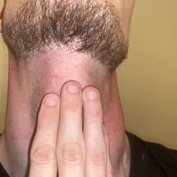 Next Level Cuts - Above my pointer finger, above my ring finger and next to my pinky.   Let alone my beard is not lined up good at all- enter at your risk - Barbers Near Me - Tracy, California