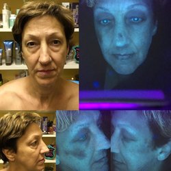 Body Boutique Spa - Skin scanner used to show hidden damage to address before it becomes visible