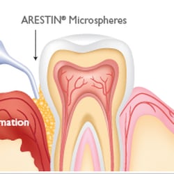 ABQ Gentle Dentistry - General Dentistry Albuquerque