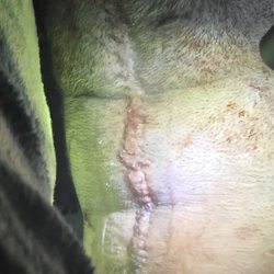 Baylor Scott & White Clinic - Temple Northside - This is the surgery from a 2 inch tumor that Dr. DUREN READY WOULD NOT GIVE HER A MRI WE BEG HIM TO HELP.