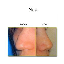 Rosenfeld Plastic Surgery