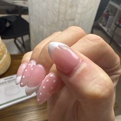 Nail growth after only being on for about four days.